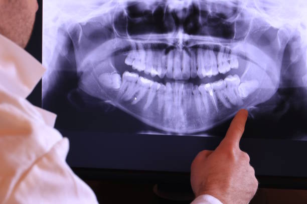 Best Emergency Dental Care for Broken or Chipped Teeth in Dawson, GA