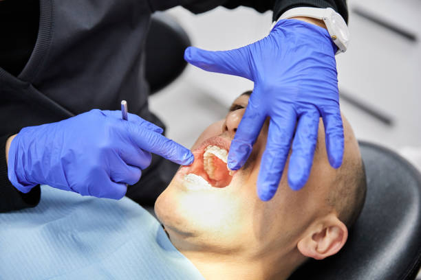 Best Emergency Tooth Extraction in Dawson, GA